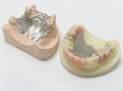 金属床義歯（メタルプレートデンチャー）
